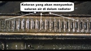 7 Cara Membersihkan Radiator yang Tersumbat Dengan Baik dan Benar [upl. by Aikahs]