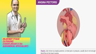 CHRONIC ANGINA PACTOTARIS [upl. by Barden]