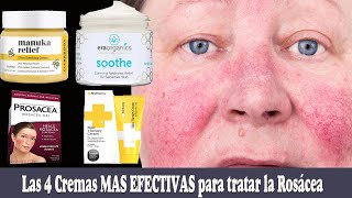 Las 4 CREMAS mas EFECTIVAS para tratar la ROSACEA [upl. by Teodoro112]