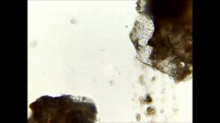 Demodex  killing in seconds with ethanol [upl. by Lombardy]