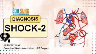 Want to Master Shock diagnosis Watch This Now  types of shock  Part 2 [upl. by Agnot]