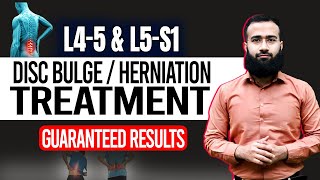 Get Rid Of L4 L5 And L5 S1 Disc Bulge With This Home Treatment  Guaranteed Results [upl. by Nomit]