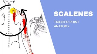 Scalenes Trigger Points [upl. by Llenrep]