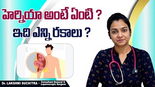 హెర్నియాలో రకాలు  Most Common Types Of Hernia In Telugu  Hernia Symptoms  Sankhya Hospitals [upl. by Einon]