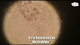 Trichomonas Hominis flagella Parasite in stool microscopystool parasite under microscope at 40X [upl. by Helali]