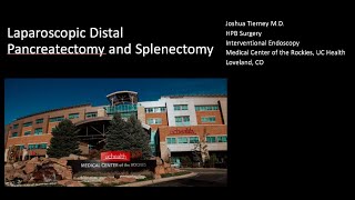 Laparoscopic distal pancreatectomy with splenectomy [upl. by Attinahs]