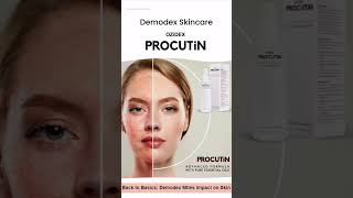 OZIDEX PROCUTiN AntiDemodex Skincare Products [upl. by Lustig]