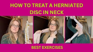 How to treat a herniated disc in neck  Dr Kristina Turkewitsch Chiropractor in Newmarket [upl. by Farnsworth]