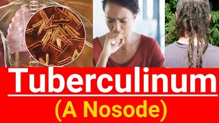 Tuberculinum homeopathic medicine  Learn which of lung is involved in different medicines [upl. by Notgnilliw932]