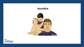 Jaundice [upl. by Ilenay]