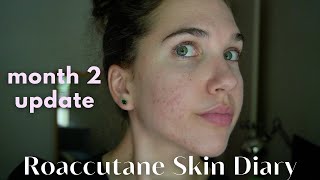 Roaccutane Daily Skin Diary  Month 2  The Purge Begins Low Dose [upl. by Netnert]