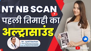 NT NB Scan  पहली तिमाही में अल्ट्रासाउंड  Ultrasound in First Trimester  Dr Jyoti Sachan [upl. by Wilkins]