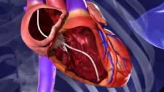 The Defibrillator Device That Can Resynchronize Your Heart [upl. by Lear718]