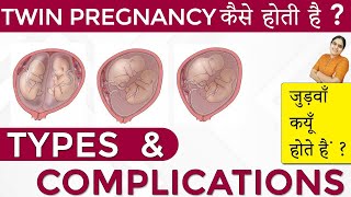 Twins Pregnancy Types Dichorionic Conjoined Monochorionic Diamniotic Monochorionic Monoamniotic [upl. by Nivahb]