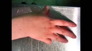 Lateralization Practice  Southlake Hand Therapy [upl. by Miharbi]