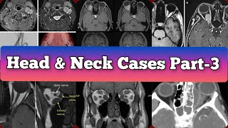 Radiology Viva Cases  386392  Head and Neck Exam Cases Part 3 medical radiology [upl. by Adnimra]