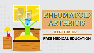 What is Rheumatoid Arthritis [upl. by Slavic]