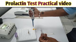 Prolactin Test practical video Full procedure with explanation LabtechGurukundanSingh [upl. by Ninnahc]