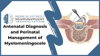 Antenatal Diagnosis and Perinatal Management of Myelomeningocele [upl. by Corbie]