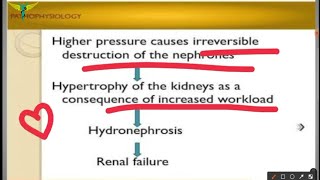 Hydronephrosis [upl. by Hafital]