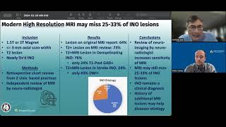 Internuclear Ophthalmoplegia INO on MRI [upl. by Thorvald]