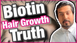 Biotin Hair Growth Truth Revealed  Is Biotin Good for Hair Growth 💇‍♂️ [upl. by Eelegna]