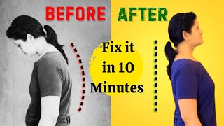 Fix Your Posture in 10 Minutes I पोस्चर सही करने के लिए योग I Posture Correction Yoga [upl. by Delacourt]