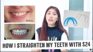 How I straighten my teeth with only 24 Really effective [upl. by Myrna]