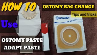 How To Change Ostomy Bag  How To Use Adapt Past  How To Use Ostomy Paste in hindi urdu [upl. by Harpole]