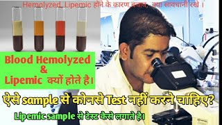 Lipemic serum and causesHemolysis sample and causesHemolyzed amp Lipemic sample [upl. by Lesly]