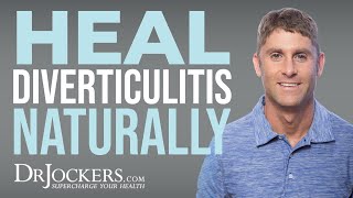 4 Steps to Heal Diverticulitis Naturally [upl. by Kirchner]