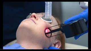 How does fractional CO2 laser resurfacing erase signs of aging [upl. by Ahsineb808]