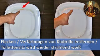 Flecken  Verfärbungen von Klobrille entfernen  Toilettensitz wird wieder strahlend weiß [upl. by Linnie442]