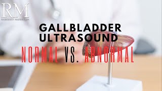 Gallbladder Ultrasound Normal vs Abnormal Image Appearances  Gallbladder Pathologies USG [upl. by Clementius606]