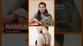 Vitiligoனால உடம்புல வலி ஏற்படுமா 😯Dermatologist Dr Poornima Explains [upl. by Terris]