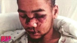 Boy Shot In The Face After Being SWATTED By Angry Gamer [upl. by Demaggio]