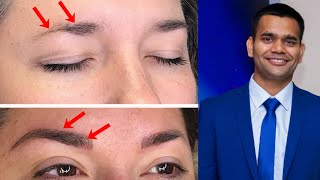 How To Grow Thicker Eyebrows Naturally and Faster  Dr Vivek Joshi [upl. by Enomal]