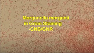 Gram Negative Rods of Morganella morganii in Gram Staining [upl. by Learrsi]