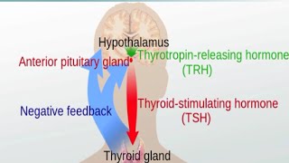 Graves Disease and Hashimotos Thyroiditis [upl. by Aihsatal]