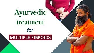 Ayurvedic Treatment for Multiple Fibroids  Swami Ramdev [upl. by Nitin]