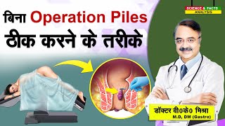 बिना Operation Piles ठीक करने के तरीके  CAN PILES BE CURED WITHOUT SURGERY [upl. by Eiuqcaj]