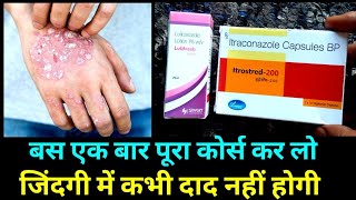 Itrostred 200 Capsules Uses in hindi And Lulifresh Lotion Uses in Hindi [upl. by Maybelle]