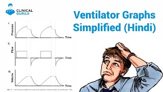 Apollo Hospitals  Demo  Making Ventilator Operation Easy [upl. by Aissatsana437]