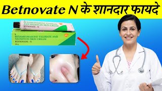 Betnovate N Cream Review in Hindi फायदे नुकसान व उपयोग विधि  Betnovate N से गोरा बने [upl. by Siekram328]