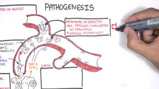 Malaria Pathophysiology [upl. by Iluj]