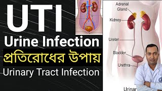 Urinary Tract Infection In Bengali  Uti Cause symptoms  ইউরিন সংক্রমনে করণীয় কি [upl. by Ahsym743]