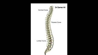 Scheuermann’s disease causes symptom diagnosis xray treatment [upl. by Mccall]