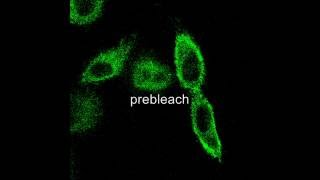 TSH receptor movement studied by fluorescence recovery after photo bleaching FRAP [upl. by Eerot585]