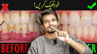 Never Get GUM DISEASE AGAIN after this Home Remedy  InqalabFareed [upl. by Aray]