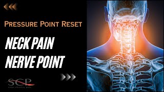 Neck Pain Nerve Point [upl. by Ralli]